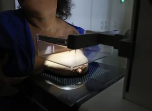 vigitel:-92%-das-brasileiras-entre-50-e-69-anos-fizeram-mamografia