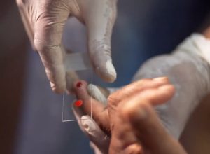 sus-comeca-a-usar-novo-tratamento-contra-a-malaria-em-criancas