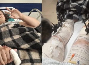 vaquinha-e-criada-para-ajudar-jovem-mae-ferida-em-acidente-em-cascavel