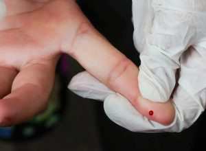 teste-rapido-de-dengue-passa-a-integrar-tabela-do-sus