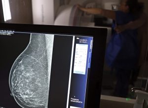 nova-lei-reforca-direito-a-tres-folgas-por-ano-para-exames-preventivos