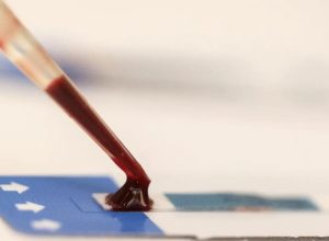 estudo-inedito-da-fiocruz-pode-ampliar-prevencao-de-hiv-entre-jovens