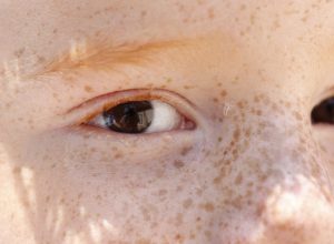 reflexo-branco-nos-olhos:-entenda-condicao-que-assusta-pais